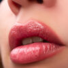 Lip Flip con Botox - GS Distribuidor