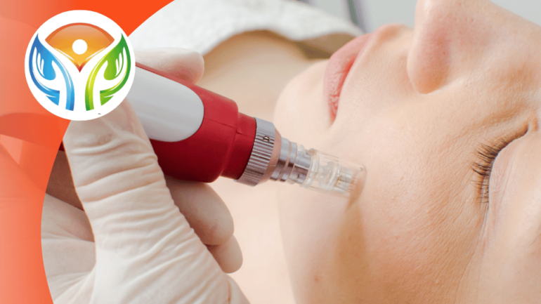 Todo sobre el Derma Pen: Beneficios y usos en tratamientos estéticos